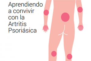 artritis psoriasica