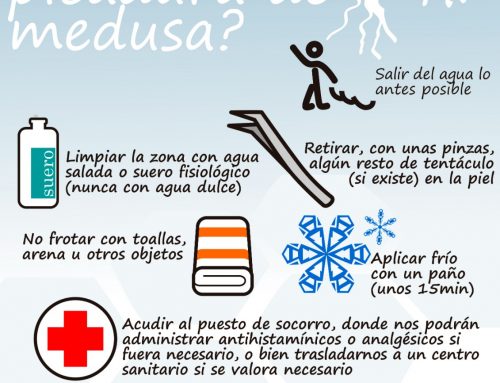 ¿Qué hacer ante la picadura de una medusa?